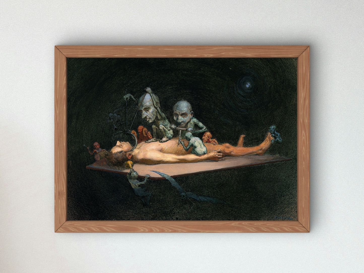 An Unconscious Naked Man Wellcome by Richard Tennant Cooper 1910, Wall Art Print, Fine Art Reproduction, Museum Quality Decor, Poster