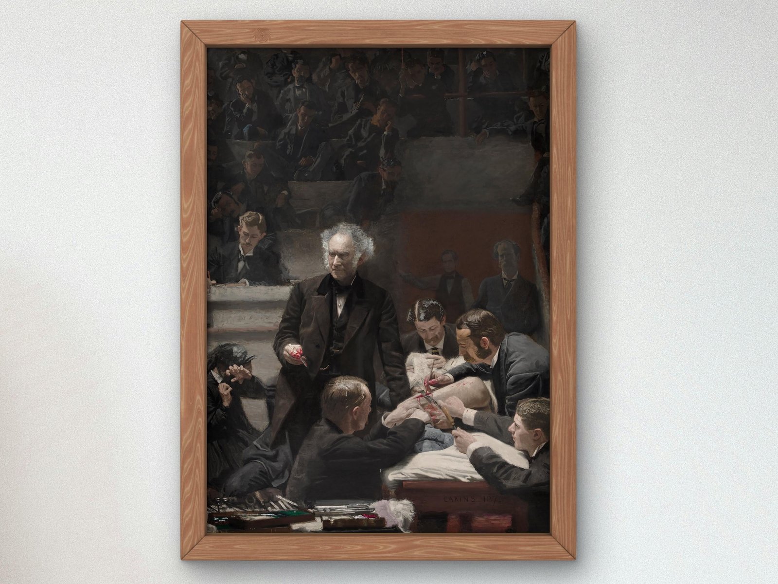The Gross Clinic by Thomas Eakins, 1875, Realism and Naturalism, fine art print