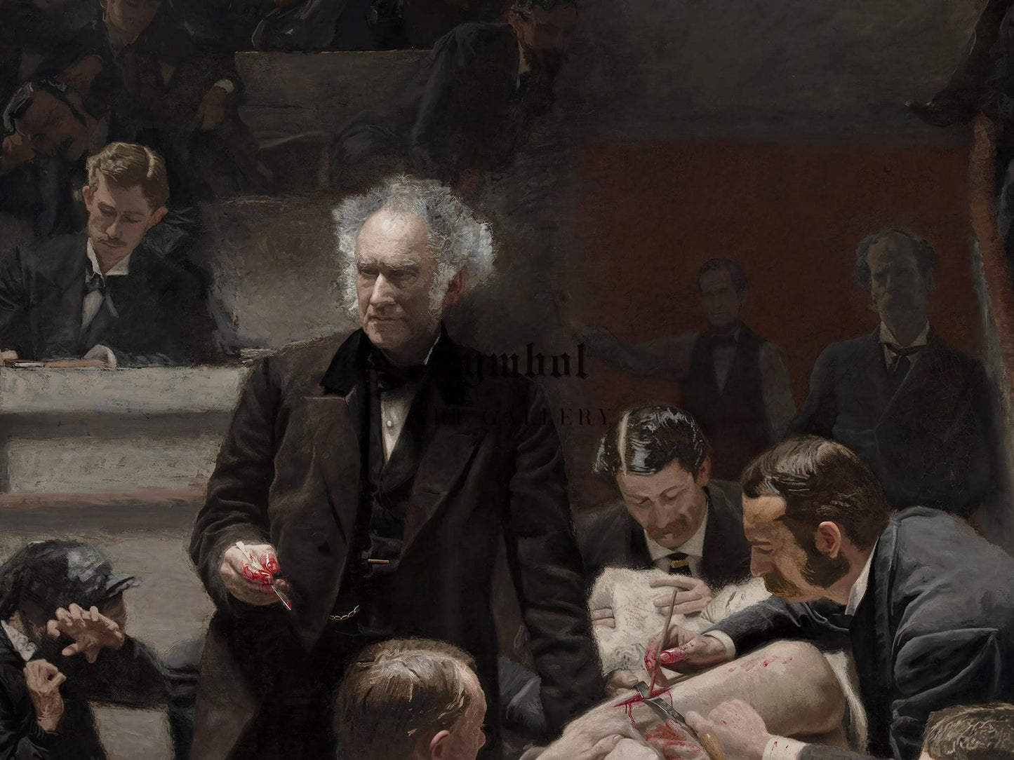 The Gross Clinic by Thomas Eakins, 1875, Realism and Naturalism, fine art print