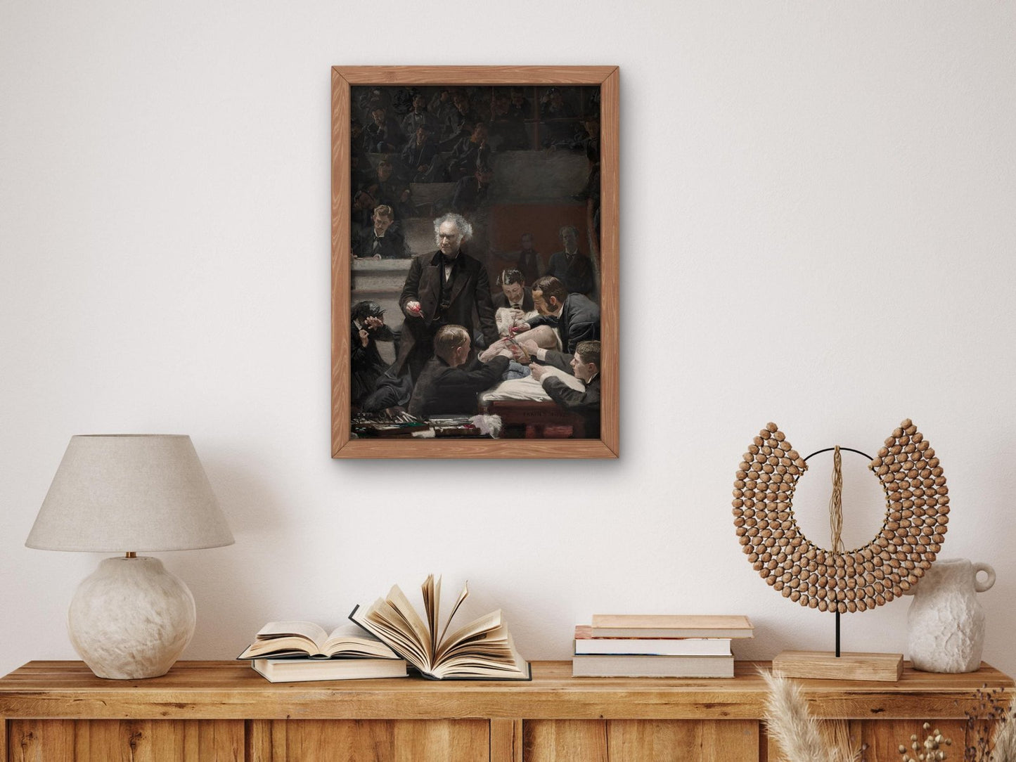 The Gross Clinic by Thomas Eakins, 1875, Realism and Naturalism, fine art print